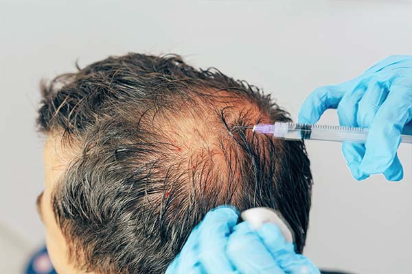 Mesotherapie