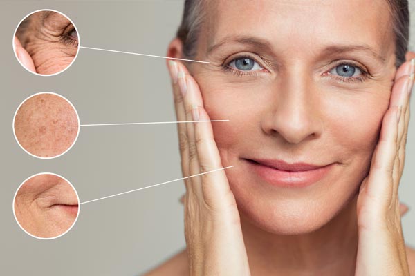 Frau mittleren Alters mit Hautverjüngung